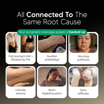 New Maximum Potency Formula - Lymphatic Drainage Capsules